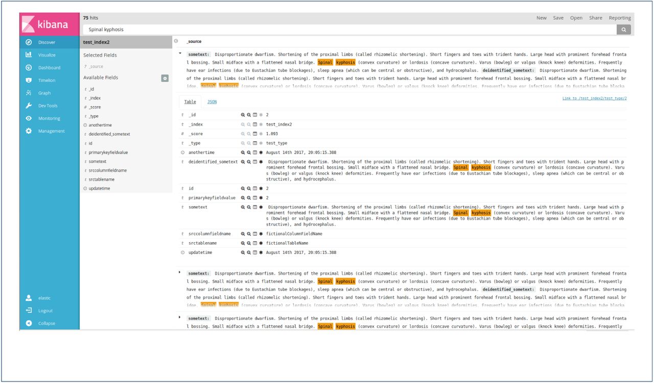 Kibana interface loaded with pseudo-data