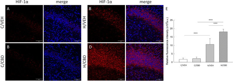 HIF-1α immunolocalization in brain sections of neonatal mice. Confocal images showing co-localization of HIF-1α (red) and Hoechst (merge) in the hippocampus area of the (A) control vehicle group (C/VEH); (B) hypoxic vehicle group (H/VEH); (C) control CBD group (C/CBD) and (D) hypoxic CBD group (H/CBD). In both control groups (panels (A) and (C)), the fluorescence was relatively weak. Scale bars: 50 µm. Panel (E)—A quantitative analysis of HIF-1α level in the neonatal mice hippocampus. Relative fluorescence intensity is expressed in arbitrary units (a.u). Values are presented as means ± SEM and ***p ≤ 0.001.