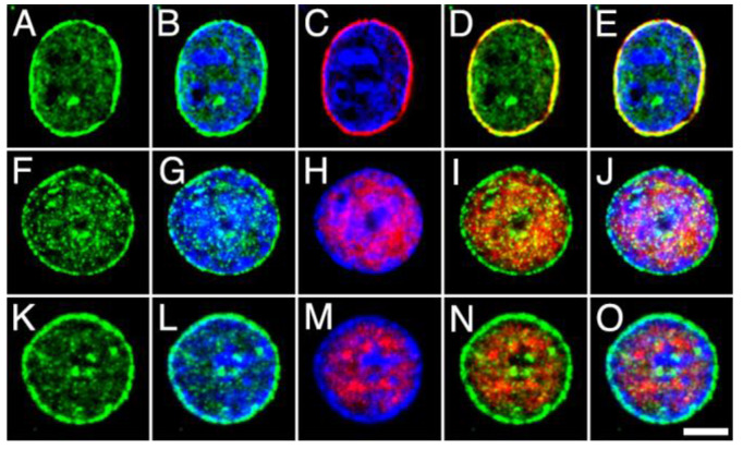 High-power micrographs of intact nuclei isolated from the adult rat brain cortex double stained with anti-COX2 (green) combined with Hoechst staining (blue) and NPCx ((A–E); red), NeuN/Fox-3 ((F–J); red) and DGLα ((K–O); red) immunostaining. All micrographs are maximum intensity projections of three consecutive 0.24 µm-thick optical sections acquired in grayscale and pseudo colored. Scale bar: 5 µm in O (applies to (A–O)).