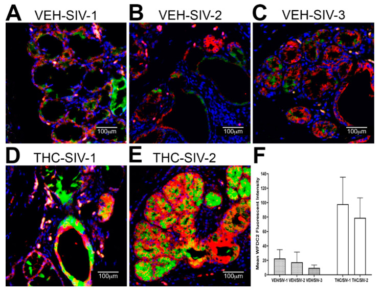 Chronic THC administration preserves WFDC2 protein expression in the minor salivary glands (MiSGs) of chronically SIV-infected rhesus macaques. (A–E) Triple labels with WFDC2 [48], cytokeratin (red) and Topro3 (blue) for nuclear staining. Note the significantly decreased WFDC2 (A–C) staining in the MiSGs of the VEH/SIV rhesus macaques. In contrast, WFDC2 (D,E) staining is intense in the MiSGs and salivary ducts of THC/SIV rhesus macaques. All panels are 40× magnification. Quantification of cells and regions of interest (ROI) labeled by WFDC2 (F) was performed using Volocity 5.5 software after capturing images on a Leica confocal microscope. Several ROI were hand drawn on the MiSG regions in the images from three VEH/SIV and two THC/SIV rhesus macaques. The mean fluorescent intensity measurements for each animal are represented as mean ± standard deviation.