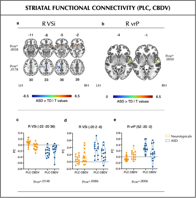 Striatal functional connectivity (FC) after placebo/drug administration. a, b Baseline between-group (ASD > neurotypicals) differences in FC of the right inferior ventral striatum (R VSi) and right ventral-rostral putamen (R vrP), respectively. Colourbars indicate T-values. Numbers above and below slices indicate Montreal Neurological Institute (MNI) z-coordinates. c–e: Group (ASD > neurotypicals) by drug (CBDV > PLC) interaction effects on atypical baseline striatal FC between the R VSi/R vrP and clusters identified above (MNI coordinates represent peak voxel locations). Graphs show average values per subject/cluster. FC functional connectivity (Fisher-transformed Pearson’s Correlation coefficients), L left, LH left hemisphere, PLC placebo, R right, RH right hemisphere, vrP ventral-rostral putamen, VSi inferior ventral striatum