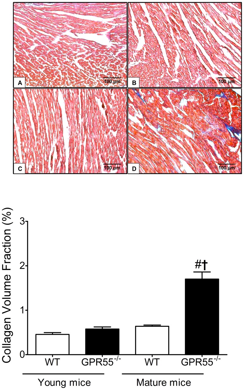 Influence of GPR55 gene deletion on cardiac collagen deposition.Representative photomicrographs (×400) demonstrating cardiac collagen deposition in young WT (A), young GPR55−/− (B), mature WT (C), and mature GPR55−/− (D) mice. Collagen deposition was significantly increased in the left ventricle of mature GPR55−/− mice (E). Data is expressed as mean±s.e.m. (n = 14–15) #P<0.05 vs. GPR55−/− (Young); †P<0.05 vs. WT (Mature).