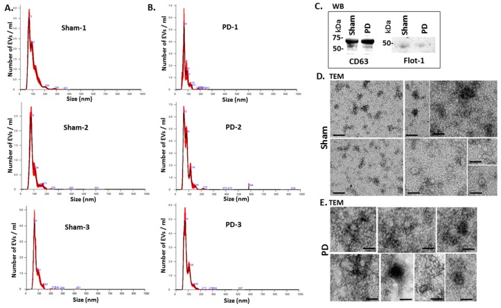 EV characterisation from rat plasma. (A) Representative Nanosight graphs showing nanoparticle tracking analysis (NTA) analysis of plasma EV profiles from sham-treated rats (Sham; n = 3). (B) Representative Nanosight graphs showing NTA analysis of plasma EV profiles from the pre-motor PD rat models (PD; n = 3). (C) Western blotting (WB) confirms that rat plasma-EVs are positive for the EV-specific markers CD63 and flotillin-1 (Flot-1); the molecular weight standard is indicated in kilo Daltons (kDa). (D,E) Transmission electron microscopy (TEM) images showing EVs isolated from sham (D) and pre-motor PD model (PD; (E)) rat plasma, revealing typical EV morphology; composite images are shown and the scale bar represents 50 nm in all images. In the NTA curves the black line represents the mean of the 5 repetitive readings per individual sample and the red line represents standard error (+/−) between those same 5 readings per sample. Each treatment group was measured in 3 biological replicates (sham; PD = pre-motor PD models).
