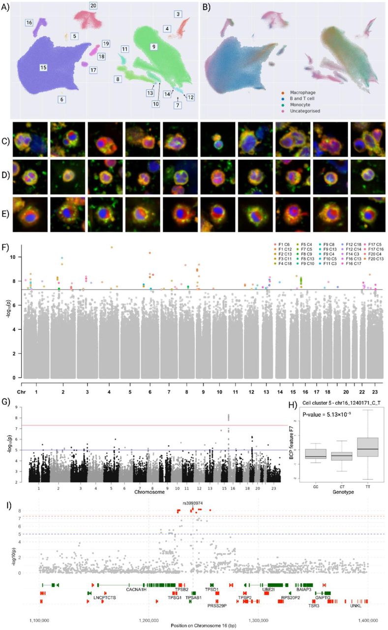 GWAS reveals distinct cell phenotypes are significantly associated with variants.UMAP of the BCP Atlas colored by A) cell clusters C3-C20 and B) cell type identified by a supervised classification procedure. Cell image examples from clusters C) C3, D) C5 and C) C13. F) A combination Manhattan plot of all 93 genome-wide significant associations (-log10(p)), where all significant associations for BCP features and clusters are highlighted. G) Genotype-phenotype associations for phenotype F7 in cell cluster C5 (-log10(p)), H) Association between lead variant rs3993974 and phenotype F7 in cell cluster C5. I) A locus zoom plot at rs3993974.