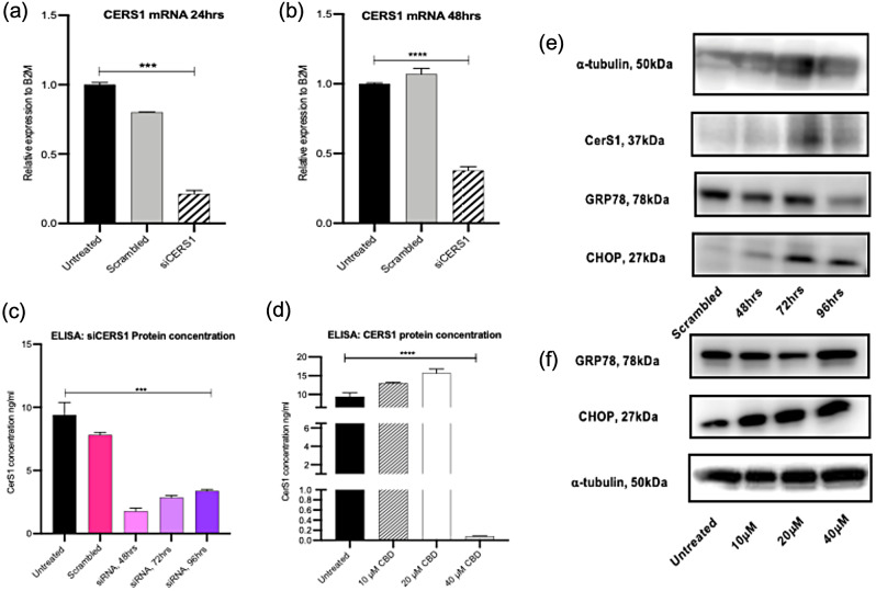 Ceramide synthase 1 knockdown reduces protein expression of GRP78 in Panc03.27 cells. (a) and (b) qPCR for CerS1 mRNA following transfection with 5 nM si-CERS1 for 24 and 48 h. (c) Bar blot of protein concentration (ng/ml) of CerS1 using ELISA following transfection with 5 nM si-CERS1 for 48, 72 and 96 h. (d) Bar blot of protein concentration (ng/ml) of CerS1 using ELISA following 48 h treatment with cannabidiol at 10, 20 and 40 µM. (e) Western blot (s) of housekeeping gene, alpha-tubulin, CerS1, GRP78 and CHOP following siRNA treatment. (f) Western blot (s) of GRP78, CHOP and alpha-tubulin following 48 h treatment with cannabidiol at 10, 20 and 40 µM