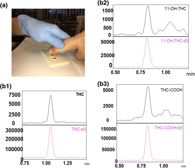 (a) Finger prick collection of blood to produce a dried plasma spot. (b1–b3) SRM LC/MS analysis of dried plasma spot from a marijuana smoker showing the presence of the parent compound, THC, along with its two main metabolites, THC-OH and THC-COOH. The lower magenta traces in each panel are the SRM LC/MS chromatogram for the corresponding deuterated internal standard for each compound. Experimental details for this approach are described elsewhere [46]. The labels below of b and bc are incorrect; they should be b1 and b2. Also, they are lower case in the figure but referenced in the text in upper case. Shouldn't they be consistent?