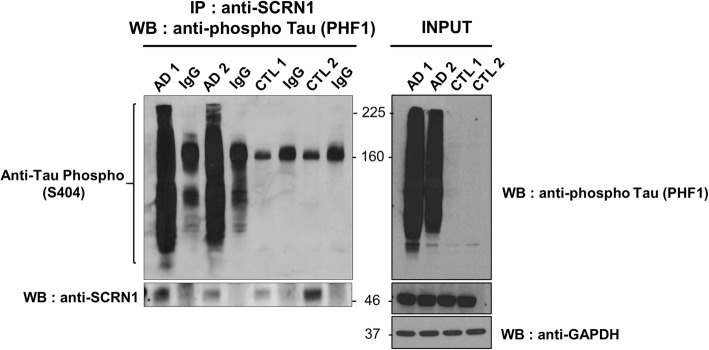 SCRN1 binds to phosphorylated tau in AD cortex tissue. Co-IP was performed on fresh frozen frontal cortex tissue from n = 2 AD and n = 2 cognitively normal samples. IP was performed using anti-SCRN1 or rabbit IgG isotype control. SCRN1 pulled down phosphorylated tau in AD cortex samples, but not control cortex samples. Fiftee microgram protein per sample from total homogenate were loaded for inputs. Loading control: GAPDH