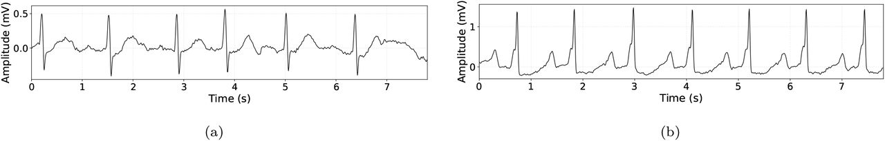 An example of (a) AFib and (b) NSR segments. These are excerpts from the AFDB dataset. The y-axis represents the ECG amplitude in mV and the x-axis shows the time in seconds.
