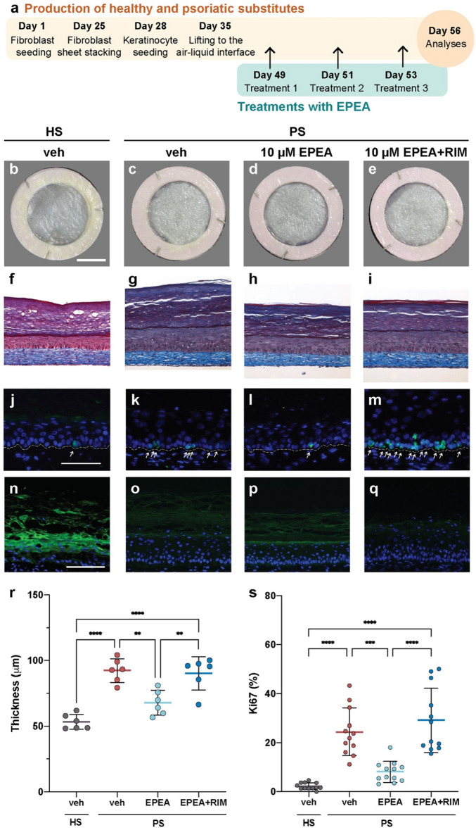 Effect of 10 µM EPEA on psoriatic keratinocyte proliferation and differentiation. (a) Schematic overview of skin substitute reconstruction according to the self-assembly method, and treatment with either 10 µM EPEA, 10 µM EPEA + RIM or the vehicle. (b–e) Macroscopic aspect and (f–i) histological appearance of cross-sections after Masson’s trichrome staining of the skin substitutes. (j–m) Detection of Ki67 (green) and (n–q) filaggrin (green) by immunofluorescence. White arrows indicate Ki67 positive cells. Nuclei were stained with DAPI (blue). The dotted line indicates the dermo-epidermal junction. Scale bars: (b–e) 1 cm, (f–q) 100 μm. (r) Epidermal thickness quantification from Masson’s trichrome-stained sections. (s) Ratio of Ki67 positive cells to the number of total keratinocytes in the basal layer. (N = 3 donors, n = 2 reconstructed substitutes per donor). Statistical significance was determined using one-way ANOVA followed by Tukey’s post-hoc test. *p < 0.05; **p < 0.01; ***p < 0.001; ****p < 0.0001. EPEA N-eicosapentaenoyl-ethanolamine, HS healthy substitute, PS psoriatic substitute, RIM Rimonabant, veh vehicle.