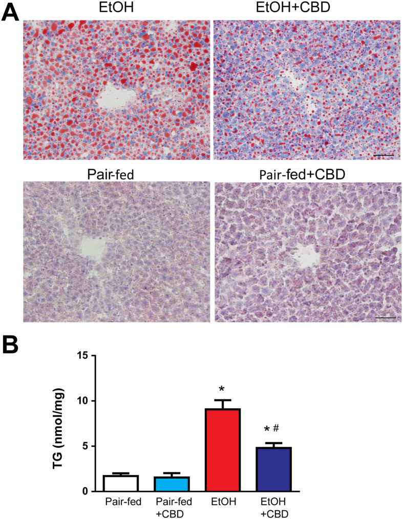 Effect of cannabidiol treatment on chronic-binge ethanol-induced liver steatosis. (A) Representative Oil red O staining of liver sections and (B) TG, liver triglyceride content from indicated groups. Values represent means ± SEM (n = 4–7). *P < 0.05 vs. Pair-fed group, # P < 0.05 vs. EtOH group determined by One-way ANOVA, followed by Tukey’s post-hoc test.