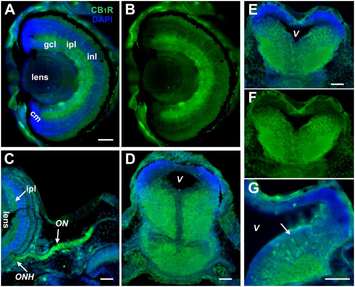 CB1R expression in the developing Xenopus visual system. (A,B) Coronal section of a retina of a stage 45 tadpole shows localization of strongest CB1R immunoreactivity (green) in the ganglion cell layer (gcl), inner nuclear layer (inl), and the inner plexiform layer (ipl). The cellular layers are clearly denoted by the DAPI staining in (A) (blue). Note the absence of CB1R immunoreactivity in the ciliary margin (cm). (C) Strong CB1R immunoreactivity is also observed in the optic nerve head (ONH) where RGC axons exit the retina, and along the optic nerve (ON). (D–F) CB1R expression in the brain is illustrated by the coronal sections of midbrain (D), caudal midbrain (E,F) and rostral hindbrain (G) where CB1R immunoreactivity (green) localizes to cell bodies that lay medially and in the adjacent neuropil of stage 43 to stage 45 tadpoles. Note the individual neuronal cell bodies and processes projecting to the neuropil with strong CB1R immunoreactivity (G, arrow). In (D,E,G), the DAPI staining highlights the lower CB1R immunoreactivity in the proliferative zones near the ventricle (V) and its absence in the dorsal-most portion of the brain. Scale bars = 50 μm. Similar patterns of CB1R immunoreactivity were obtained with two commercial antibodies to CB1R (A,B,E–G; Cayman Chemicals, and C,D; Calbiochem).