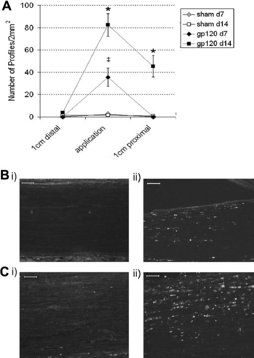 The presence of macrophages in the HIV-1 gp120 treated sciatic nerve. (A) Immunohistochemical analysis of the sciatic nerve reveals the presence of immunoreactivity for the macrophage marker CD68 at the site of administration of HIV-1 gp120 by day 7 (♦n = 6) and day 14 (■ n = 6) as well as a spread of macrophages into the distal nerve by day 14 as compared to no significant CD68-IR in the RSA (sham) treated nerve at day 7 (n = 6) or day 14 (□ n = 6). Statistical significance of differences between groups (P < 0.05) was determined by an ANOVA with Dunn’s all pairwise multiple comparisons where * represents significant difference from all other group and ‡ represents significance from the appropriate sham control group. Each value is the mean ± SEM. (B–C) Examples of CD68-immunoreactive profiles at the site of (i) RSA or (ii) HIV-1 gp120 administration at (B) day 7 and (C) at day 14. Scale bar = 100 μm.