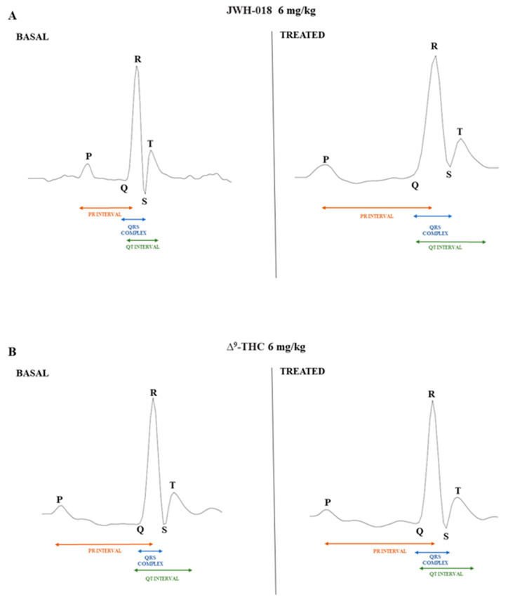 ECG waves after vehicle and JWH-018 (6 mg/kg) treatment (panel (A)) and ECG waves after vehicle and ∆9-THC (6 mg/kg) treatment (panel (B)). Waves were recorded with ecgTUNNEL system (Emka Technologies) and exported after analysis with iox2 software.