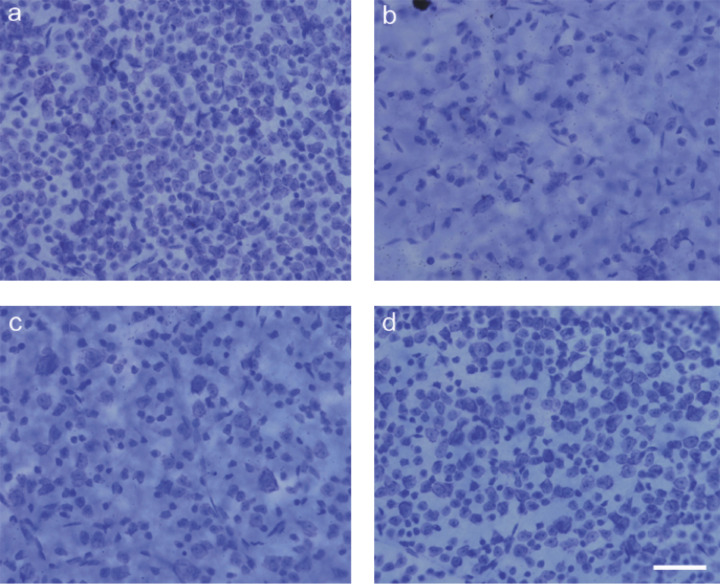Photomicrographs of stained retinal ganglion cells from injected eyesPhotomicrographs of mouse eyes from one mouse that had received: (A) an injection of saline, (B) an injection of NMDA. Photomicrographs of mouse eyes from one mouse that had received: (C) NMDA and (D) NMDA with WIN 55,212-2. The NMDA injections were found to significantly reduce the number of RGCs, and the addition of WIN 55,212-2 was found to protect against NMDA-induced neurodegeneration. Scale bar = 50 µm.