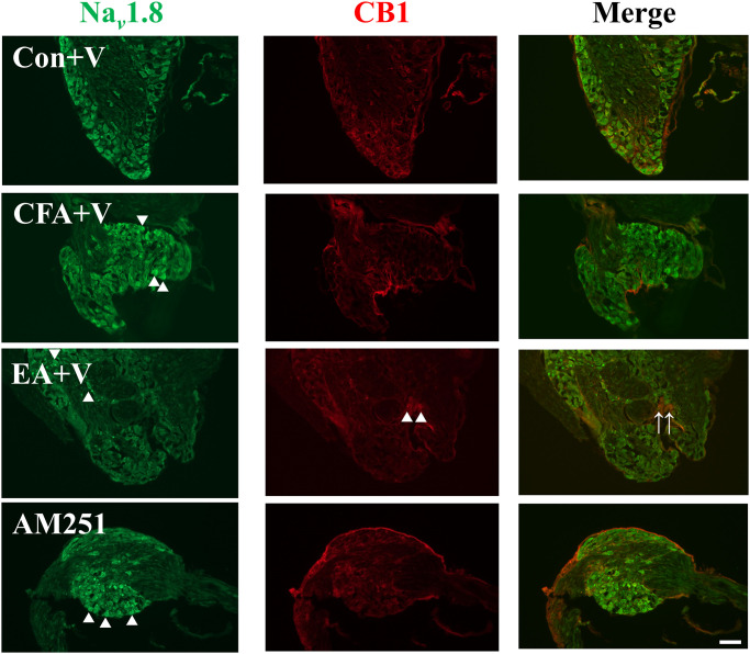 AM251 treatment blocked cellular modulation effects of Nav 1.8 and CB1 mediated by EA in the DRGs.Nav 1.8 immunoreactive cells (green) and CB1 immunoreactive cells (red) were merged (yellow, marked by arrowhead). CFA injection raised expression of Nav 1.8 in the CFA+V and AM251 group (marked by triangle). EA raised expression of CB1 (marked by triangle) and decreased expression of Nav 1.8 in the EA+V group (scale bar = 100 μm, n = 3).