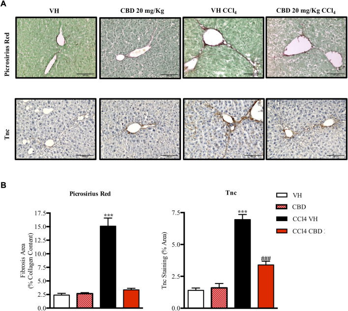 CBD reduces liver fibrosis induced by CCl4. (A) Representative images of collagen staining in the liver using picrosirius red dye (upper panel) or immunostaining with Tnc (bottom panel) from control, CBD, CCl4-vehicle, and CCl4 + CBD mice. Scale bars represent 100 and 50 μm, respectively. (B) Quantification of positive collagen content (left panel) and Tnc staining (right panel), expressed as a percentage of the total liver area. Values are expressed as mean ± SEM (n = 6 animals per group). ***p < 0.001 vs. control group; ### p < 0.001 vs. CCl4 group (ANOVA followed by Tukey’s test).