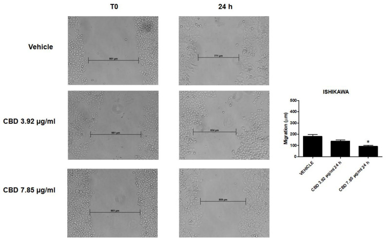 CBD treatment inhibited migration of Ishikawa cells. Wound-healing assays for Ishikawa cells after treatment with CBD 7.85 µg/mL and 3.92 µg/mL for 24 h. All experiments were repeated three times and images were taken at 0 and 24 h (20×). Data are presented as the mean ± SD. * p < 0.05 vs. untreated.