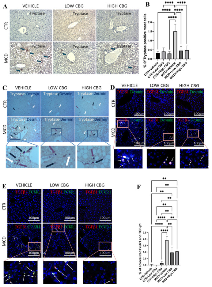 The infiltration of mast cells and crosstalk with HSCs via TGF-β1. (A) Representative images of the immunohistochemistry staining of beta tryptase (Tspb1) of the FFPE liver sections from mice of each group. Tspb1-positive mast cells (Brown) are indicated by blue arrows found near the portal triad. The cell nuclei are counterstained with hematoxylin. Original magnification, ×200. (B) The quantification of the level of tryptase-positive mast cells. (C) Representative images of the co-staining of tryptase and desmin with the immunohistochemistry staining of the FFPE liver sections from mice of each group. Tryptase-positive mast cells (brown) are indicated by white arrows, desmin-positive HSCs (purple) are indicated by purple arrows, and colocalized mast cells and HSCs are indicated by blue arrows. All three are found near the portal triads. Original magnification, ×200. (D) Representative images of the immunofluorescence staining of co-localized desmin and TGF-β1 in the frozen liver sections from mice of each group. White arrows indicate the overlap of DAPI (blue), desmin (green), and TGF-β1 (red), highlighting that TGF-β1 secreted from mast cells further activates hepatic stellate cells near the portal triads to promote fibrogenesis. (E) Representative images of immunofluorescence staining for the colocalization of FcεRI and TGF-β1 in the frozen liver sections from mice of each group. DAPI stains the nucleus of the cells. White arrows indicate the overlap of DAPI (blue), FcεRI (green) and TGF-β1 (red), meaning that TGF-β1 is secreted from the mast cells. Original magnification, ×200. (F) The quantification of the level of co-localized FcεRI and TGF-β1. ** p < 0.01; **** p < 0.0001. Quantification is performed via ImageJ software.