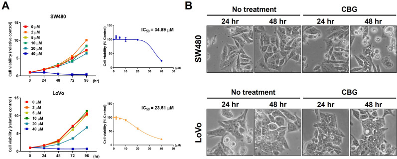 CBG inhibits cell growth and changes cell morphology. (A) Cell viability was determined using MTT assay for 96 hours. IC50 value of CBG was 34.89 μM for SW480 cells and 23.51 μM for LoVo cells. (B) Cell morphology was observed with a phase contrast microscope after CBG treatment. Dead cells and cytoplasmic vesicles were shown in CBG-treated cancer cells.