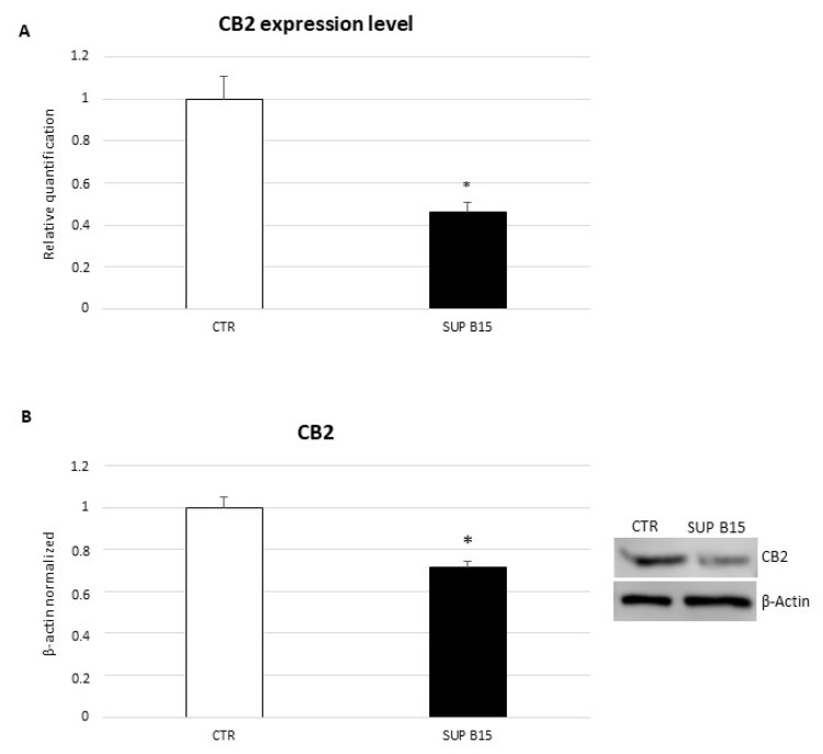 CB2 gene (A) and protein (B) expression levels in SUP-B15 cell line compared with CTR lymphocytes. For real-time PCR (A), CB2 mRNA expression levels of SUP-B15 cell line are compared with healthy controls-derived lymphocytes (CTR). Results are normalized for the housekeeping gene β-actin, and shown as mean ± S.D. of three independent experiments * indicates p ≤ 0.05 compared to CTR. Western blot (B) was performed starting from 20 μg of total lysates. The most representative images are displayed. The proteins were detected using Image Studio Digits software, and the intensity of immunoblots compared to the control, taken as 1 (arbitrary unit), were quantified after normalizing with respective loading controls for the housekeeping protein β-actin. Histogram shows CB2 receptor expression levels as the mean ± S.D. of three independent experiments. A t-test was used for statistical analysis. * indicates p ≤ 0.05 compared to CTR.