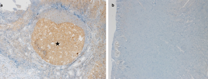 a Caspase-3 antibody positive control, follicle germinal center, tonsil (star). × 100, b Negative staining of the heart with caspase-3 antibody, SAHD group. × 100