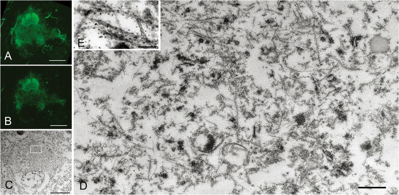 Correlation of immunolabeled LM and EM images of pretangles in a severe case of CBD. In a pretangle neuron from a severe case of CBD (case 4), reticular tau immunoreactivity was denser on 3D reconstruction (A). When focusing on the denser area of round inclusion (B, C), the corresponding EM section contained abundant tau-positive straight filaments that did not form a parallel arrangement (D). These straight filaments were thicker with a diameter of 15–20 nm (E). Scale bars in A-C = 10 μm; D = 500 nm; E = 100 nm.