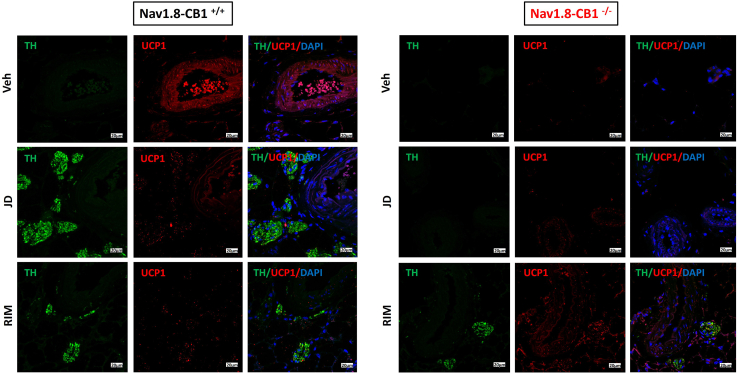 CB1 deletion in sensory neurons eliminates the thermogenic effect of CB1 antagonism in visceral WATTH and UCP1 co-expression—assessed by immunofluorescence (IF) in HF diet-fed Nav1.8-CB1+/+ and Nav1.8-CB1−/− male mice after 15 days of administration of peripherally restricted CB1 antagonist (JD) vs. non-restricted CB1 antagonist (Rim) vs. vehicle (Veh). n = 3–4. DAPI = blue, TH = green, UCP1 = red. Scale bars, 20 μm.