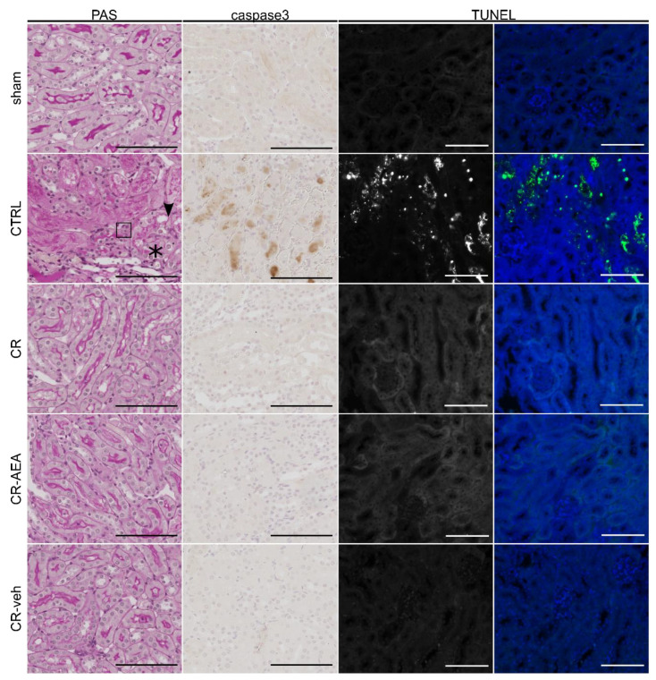 Histological confirmation: intraperitoneal AEA administration does not abrogate the protective effect of CR. Histological analyses reveal higher tubular damage in ad libitum fed animals in comparison to calorically restricted male mice. AEA-injection does not abrogate the protection by CR in mice.Abb.: Asterisk: brush border loss, arrowhead: epithelial flattening; CR: caloric restriction; CR-AEA: calorically restricted mice treated with AEA-injections on the last eight days prior to ischemia-reperfusion injury (IRI); CR-veh: calorically restricted mice treated with vehicle-injections on the last eight days (d) prior to ischemia-reperfusion injury (IRI); CTRL: no preconditioning; d: day; IRI: ischemia-reperfusion injury; sham: right nephrectomy followed by no-clamping of the left renal pedicle; square: pyknosis; PAS: Periodic acid-Schiff reaction; caspase3: immunohistochemical staining against cleaved-caspase3; Scale bar: 100 µm; TUNEL: TdT-mediated dUTP-biotin nick end labeling.