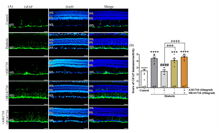 Effect of cannabinoid treatment on Müller cell activation in the diabetic retina. (A) Representative photomicrographs of GFAP immunoreactivity (GFAP-IR). Magnification: 20×. Scalebar: 50 μm. (B) Quantification studies of GFAP IR. Diabetes increased reactive Müller cells (**** p < 0.0001 compared to Control). AM1710 restored GFAP-IR to Control levels (#### p < 0.0001 compared to diabetic untreated, p > 0.05 compared to Control). SR141716 did not affect the diabetes-induced upregulation in GFAP-IR (p > 0.05 compared to diabetic untreated, *** p = 0.0003 compared to Control, +++ p = 0.0008 compared to AM1710). Dual treatment with AM1710+ SR141716 failed to block the diabetes-induced increase in GFAP expression (p > 0.05 compared to diabetic untreated, **** p < 0.0001 compared to Control, ++++ p < 0.0001 compared to AM1710). Data are expressed as mean ± S.D and presented in a form that combines a bar diagram and scatter dot plot, with every dot representing a different value. One-way ANOVA was employed for the statistical analysis of all data, followed by Tukey’s multiple comparison test. Differences were considered statistically significant when p < 0.05.