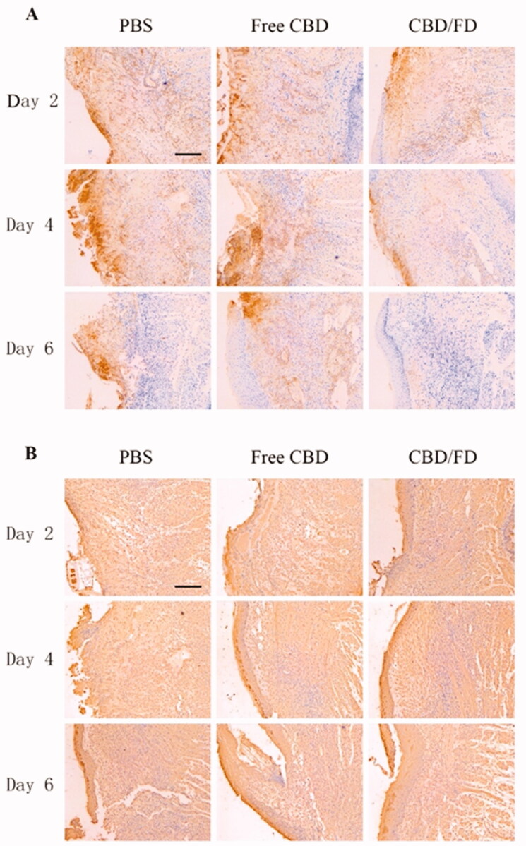 Immunohistochemical staining of (A) Ly6G cells and (B) NF-κB p65 in tongue ulcers after in situ dripping of CBD/FD nanomicelles. Scale bar, 100 μm.+