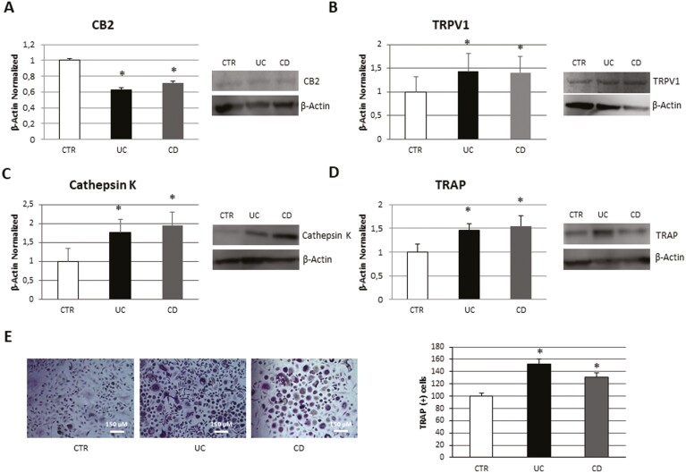 (A) CB2, (B) TRPV1, (C) cathepsin K, and (D) TRAP protein expression in OCs from 7 patients with UC and 7 patients with CD compared with OCs from 7 healthy donors (CTR). Protein levels were determined by Western blot, loading 15 μg of total lysate. The most representative images are displayed. The protein bands were detected through Image Studio Digits software. The intensity ratios of immunoblots, compared to CTR, taken as 1, were quantified after normalizing with respective controls. The relative quantifications for CB2, TRPV1, cathepsin K, and TRAP expression, normalized for the housekeeping protein β-actin, are represented in histograms as the mean ± SD of independent experiments on each individual sample. (E) TRAP assay on 7 patients with UC and 7 patients with CD compared with OCs from 7 CTR. The most representative images are displayed. TRAP (+) multinucleated (n ≥ 3) OCs, stained in purple, were counted through an AE2000 inverted microscope at 10x magnification, in at least 3 different wells for each individual sample. The percentage number of TRAP (+) cells respective to the total cell number for each sample is presented in the histogram as the mean ± SD. A Student t-test was used for the statistical analysis. *P ≤ .05 compared to CTR. Abbreviations: CB2, cannabinoid receptor type 2; CD, Crohn’s disease; CTR, controls; OC, osteoclasts; SD, standard deviation; TRAP, tartrate-resistant acid phosphatase; TRPV1, transient receptor potential vanilloid type-1; UC, ulcerative colitis.