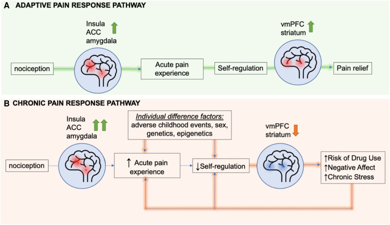 A heuristic feed-forward model of overlapping stress circuits and circuits driving risk of chronic pain. Presentation of a noxious stimulus results in activation of the insula, amygdala, and dorsal anterior cingulate cortex (dACC). In the adaptive pain pathway, the ventromedial prefrontal cortex (VmPFC) and striatum engage soon after the start of the acute pain experience to regulate nociceptive signals, thereby mediating pain relief. In chronic pain, factors such as adverse childhood events, sex, genes, drug use, negative affect, and stress can all increase the activity of the insula, dACC and amgydala following noxious stimulus presentation and also result in hypoactivation of the VmPFC and striatum, identified as the resilient coping and self regulation circuit. This hypoactivation impairs self-regulation of not only stress but also pain states, thereby extending the pain experience. Both heightened pain sensitivity and longer lasting pain predispose patients to risk of drug use, negative affect, and chronic stress, that in turn creates a feed-forward sensitized pathway towards more hypoactivation of the coping and self regulation circuit, thereby increasing risk of sustained pain symptoms and chronic pain.