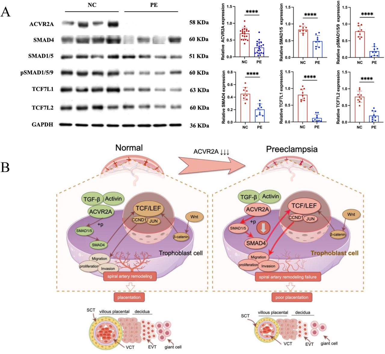 Reduced ACVR2A expression impairs SMAD and TCF7/c-JUN signaling in pre-eclampsia, leading to abnormal trophoblast function.(A) Western blot analysis showing reduced expression of ACVR2A, SMAD4, SMAD1/5, pSMAD1/5/9, TCF7L1, and TCF7L2 in PE placental tissues compared to normotensive controls. GAPDH was used as a loading control. Densitometric analysis quantifying protein expression levels is shown in the accompanying bar graphs. Data are presented as mean ± SD (n = 10 for each group). Statistical significance was determined using a two-tailed Student’s t-test (**p < 0.01; ****p < 0.0001).(B) Schematic illustration of the proposed mechanisms by which ACVR2A regulates trophoblast cell function in normal and pre-eclampsia conditions. (Colors: Green indicates normal conditions and functional pathways, while red highlights abnormalities or disrupted pathways in pre-eclampsia. Arrows: Solid Dark Brown Arrows: Normal signaling pathways and interactions. Bold Red Arrows: Disrupted or abnormal signaling pathways in pre-eclampsia.) In normal placentas, ACVR2A activates the SMAD1/5-SMAD4 axis, promoting trophoblast invasion, migration, and spiral artery remodeling via the TCF7/c-JUN pathway. In pre-eclampsia, reduced ACVR2A expression impairs SMAD signaling, leading to downregulation of TCF7 and its downstream targets (e.g., CCND1 and JUN), contributing to poor placentation. (draw by FigDraw).
