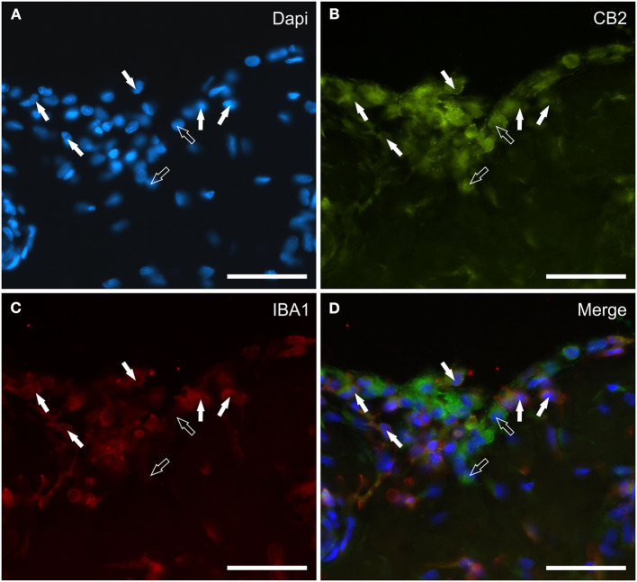 Photomicrographs of the cryosections of the synovial membrane of a horse metacarpophalangeal joint showing cannabinoid receptor type 2 (CB2) (B) and IBA1 (C) immunoreactivity. The white arrows indicate the DAPI (Blue) labeled nuclei (A) of some round macrophage-like synoviocytes lining the joint cavity which co-expressed IBA1 (Red) and bright CB2 (Green) receptor immunoreactivity. The open arrows indicate two cells expressing CB2 receptor immunoreactivity (likely fibroblast-like synoviocytes) which were IBA1 negative. (D) Merged image (Orange). Scale bar = 50 μm.