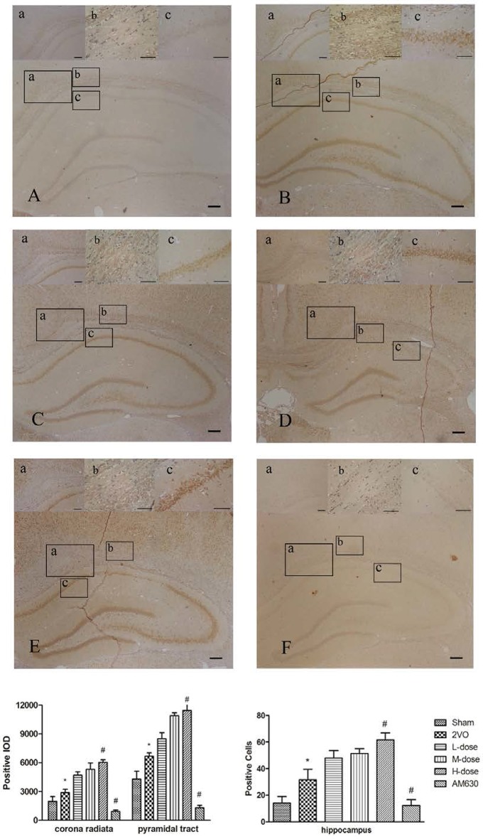 Immunohistochemical staining showed the expressions of CB2 in corona radiata (a), pyramidal tract (b) and hippocampus CA1 region (c) in different groups: sham group (A), 2VO group (B), BCP low dose group (C), BCP middle dose group (D), BCP high dose group (E), and AM630 group (F). The expression levels of the CB2 increased in the 2VO group compared with those in sham group. The HPβCD/BCP significantly increased the expression levels of CB2, and the CB2 expression levels increased with the increase of BCP concentration. In the AM630 group, the CB2 presented extremely low expression levels. The bar is 100 μm (*P < 0.01 vs. sham group, #P < 0.001 vs. 2VO group).