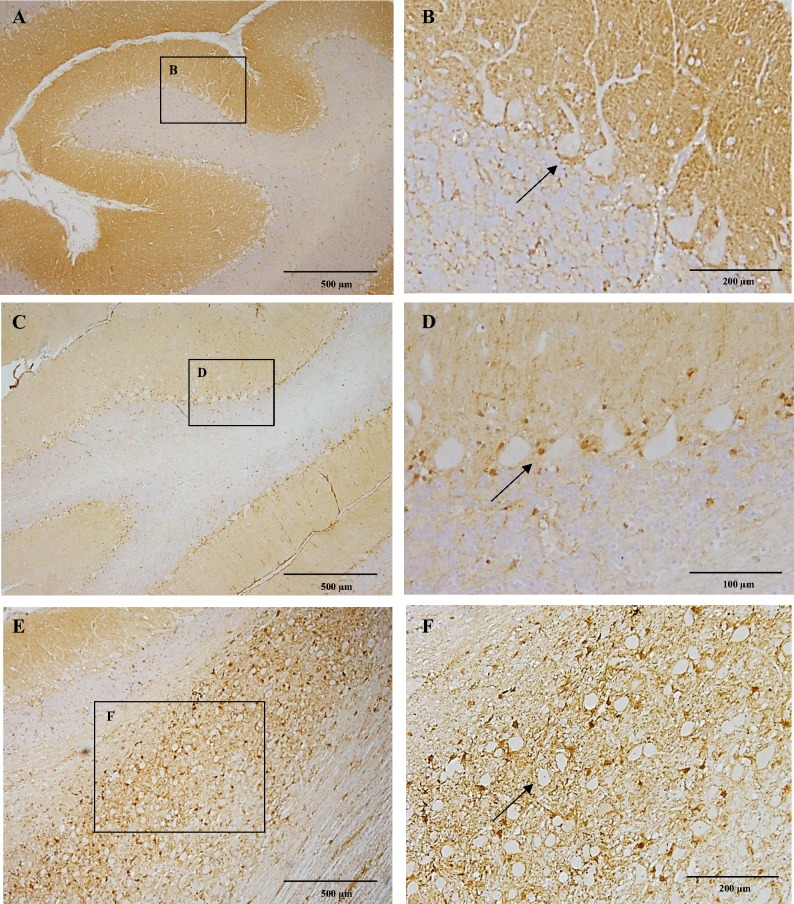 CB1 immunoreactivity of the cerebellum and choclear nuclei.In figure A notice strong CB1 immunoreactivity within the molecular layer of the cerebellar cortex in a six-month-old Beagle dog. Figure B depicting in detail immunonegative Purkinje cells surrounded by strong immunorreactive fibers particularly in the basal portion (arrow). In the ten-year-old dog, there is a slight immunoreactivity in the molecular layer of the cerebellar cortex (C). Purkinje cells surrounded by a dot-like immunoreactivity appear devoid of immunoreactivity in the ten-year-old dog (D; arrow). The cochlear nucleus in a six-month-old dog showing strong CB1 immunoreactivity (E). In figure F detail of the cochlear nucleus with strong CB1 immunoreactivity surrounding the unstained neuronal bodies (arrow). IHC was performed using the avidin-biotin-peroxidase complex (ABC) method.
