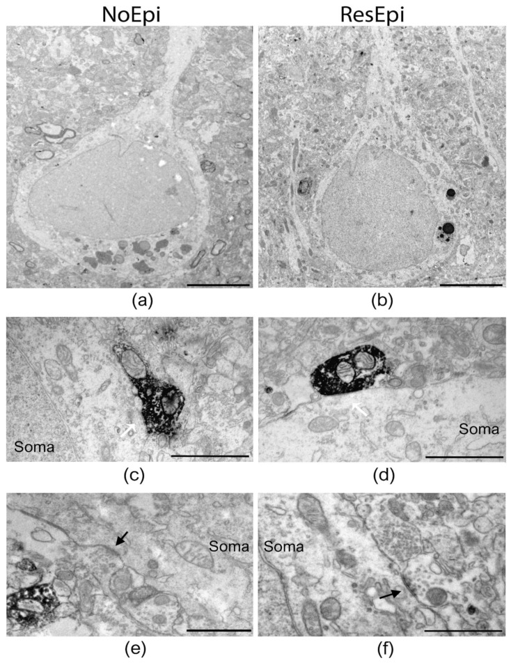 Electron microscopy of temporal neocortical slices stained with PV. Low magnification electron micrographs (a,b) show layer 2/3 pyramidal cells in the temporal neocortex of NoEpi (a) and ResEpi (b) patients in sections stained with the perisomatic interneuron marker PV. High magnification electron microscopic images show PV-positive axon terminals giving symmetric (presumably inhibitory) synapses to the soma of layer 2/3 pyramidal cells (white arrows on (c,d)), both in non-epileptic (c) and epileptic (d) tissue. Non-stained boutons also terminated on the cell body membrane of the pyramidal cells (black arrow on (e,f)), both in NoEpi (e) and ResEpi (f). All pictures were taken from regions where SPA was generated. Scale bars: (a,b): 5 µm, (c–f): 1 µm.