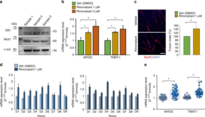 Pharmacological role of CB1 in primary human muscle cells. a Representative blot for CB1 and PAX7 protein expression in primary human satellite cells. The approximate molecular mass for each of these proteins (expressed in kDa) is shown on the right. b Bar graph showing the mRNA expression levels of MYOG and TNNT-1 in satellite cells exposed to DM for 5 days +/− rimonabant 1–3 µM. Each bar is the mean ± SEM of four separate determinations. c Morphological analysis of myotube formation in human primary satellite cells exposed to DM for 5 days in the presence of vehicle (DMSO, control) or rimonabant 1 µM. MyHC (red) and DAPI (blue). (Scale bar, 10 μm). The fusion index was calculated in both vehicle (DMSO)- and rimonabant-treated cells exposed to DM for 5 days. The asterisk denotes the P ≤ 0.05 vs. vehicle-treated cells. d Bar graphs showing the MYOG and TNNT-1 mRNA expression levels in primary human myoblasts isolated from each DMD donors (D1–D9) and induced to differentiate in presence of vehicle (DMSO) or rimonabant (1 µM). The quantification of transcripts was performed in quadruplicate by quantitative real-time PCR. The error bars correspond to the internal SEM. e The graph shows the differences in the expression levels of MYOG and TNNT-1 between vehicle- or rimonabant-treated myoblasts calculated by combining the DMD patient’s results together. Each bar is the mean ± SEM of the data from the nine patients, each of which was obtained from at least four separate determinations (see d). *P ≤ 0.05 vs. vehicle group, determined by Student’s t test
