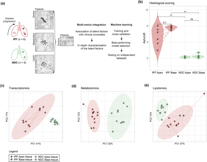 Study design and overall multi‐omics data variance. (a) Multi‐omics data (transcriptomics, metabolomics and lipidomics) from idiopathic pulmonary fibrosis (IPF) and non‐diseased controls (NDC) apex and base lung samples were integrated in an unsupervised fashion. Factors correlating with clinical metadata were investigated and used as input for machine learning and validation on an independent dataset. (b) Violin plots of lung tissues histological scoring (Ashcroft score) comparing disease groups and lung tissue location. Principal component analysis (PCA) of normalised transcriptomics (c), metabolomics (d) and lipidomics (e) data with ellipses representing the 95% confidence intervals for each group. Colours are representative of disease status with dashed lines linking the apex and base samples obtained from the same individual. Sample sizes are 6 IPF apex, 6 IPF base, 5 NDC apex and 5 NDC base. Statistics represent the result of FDR‐corrected non‐parametric Wilcoxon Rank Sum testing with FDR < 0.05, < 0.01 and < 0.001 represented as *, ** and ***, respectively.