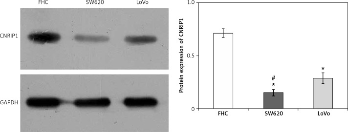 CNRIP1 protein expression levels within colon cell lines. The CNRIP1 protein expression level within the SW620 colon cancer cell line was significantly lower (0.151 ±0.03; p < 0.05) than within the LoVo colon cancer (0.287 ±0.05) and normal FHC colon cell lines (0.711 ±0.04). CRNIP1 protein expression was determined by Western blotting*p < 0.05 (SW620 vs. FHC), #p < 0.05 (SW620 vs. LoVo).