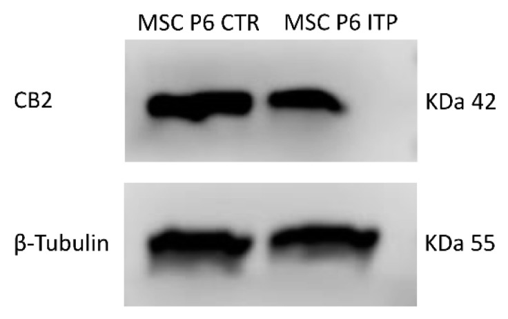 Protein density was determined by Western blotting, starting from 15 μg of total lysates. The most representative image is displayed. The proteins were detected using Image Studio Digits software.