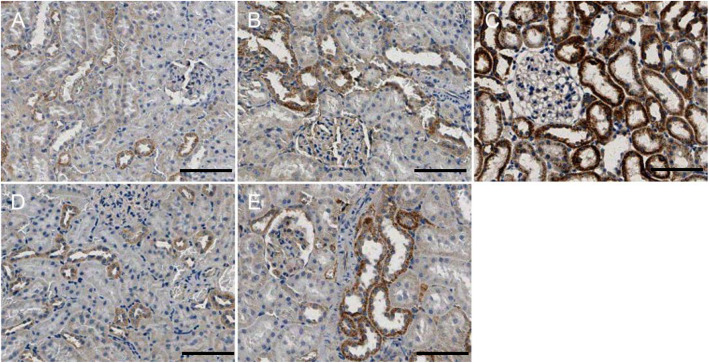 P66shc protein expression in rat renal tissue. Immunohistochemical labelling of p66shc in renal tissue in each group. a: NC; b: 4w CIH; c: 6w CIH; d: 4w CIH + Ri; e: 6w CIH + Ri. Original magnification, × 200. Scale bars, 50 μm