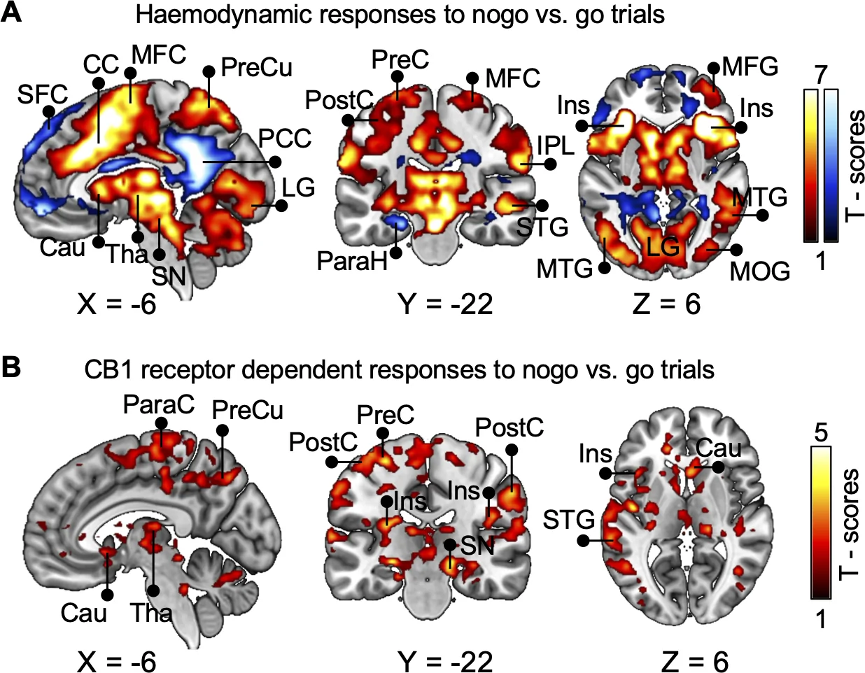 Brain imaging figure with two rows of sagittal, coronal, and axial slices at X=-6, Y=-22, Z=6. Panel A shows hemodynamic responses to nogo versus go trials with labeled regions including SFC, CC, MFC, PreCu, PCC, Cau, Tha, SN, PreC, PostC, IPL, STG, ParaH, MFG, Ins, MTG, MOG, LG. Panel B shows CB1 receptor-dependent responses with labels ParaC, PreCu, Cau, Tha, PreC, PostC, Ins, SN, STG.