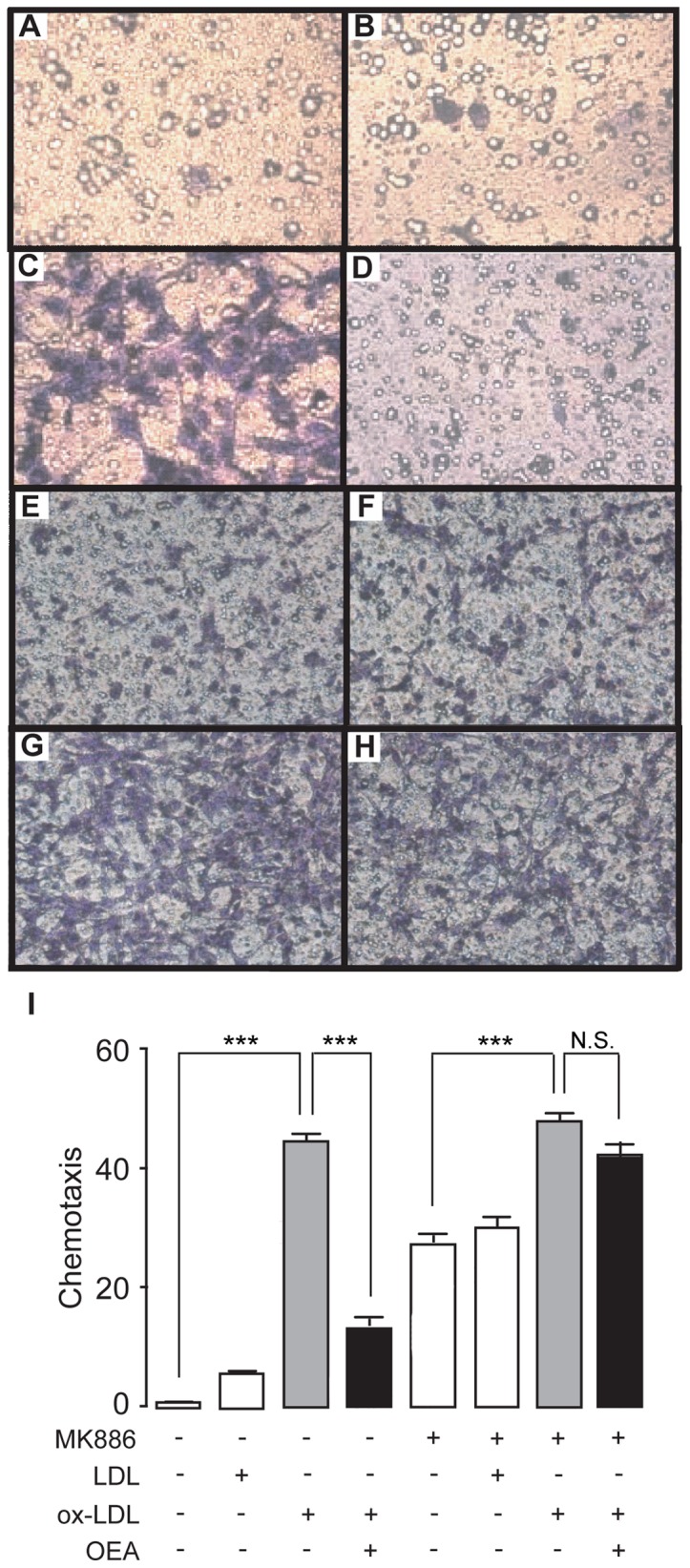 OEA reduced ox-LDL-induced VSMC migration via PPAR-α signaling.(A–H), The effect of vehicle (A), LDL (B), ox-LDL (C) ,OEA (D) and MK886 (E–H) on VSMC migration, assessed by transwell assay; (I) Quantitation of chemotaxis of A–H. Vehicle, 0.1% DMSO; LDL, 50 μg/ml; ox-LDL, 50 μg/ml; OEA, 50 μM; MK886, 10 μM. *** p<0.001, one-way ANOVA, n = 6.