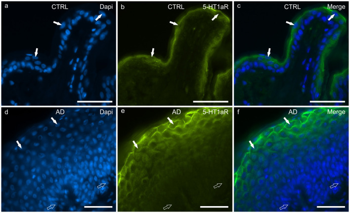 Photomicrographs of cryosections of canine skin showing showing serotonin 1a receptor (5HT1aR) immunoreactivity (IR) in the tissues of the healthy dogs (CTRL) (a–c) and in the dogs with atopic dermatitis (AD) (d–f). (a–c) The white arrows indicate the DAPI-labeled nuclei of some keratinocytes of the suprabasal layer showing bright 5-HT1aR-IR. (d–f) In the AD dogs, the cell membrane of the more superficial keratinocytes showed very bright 5-HT1aR-IR whereas the germinative cells of the basal layer and the deepest cells of the suprabasal layer were either nearly 5-HT1aR negative or expressed very faint 5-HT1aR-IR. Bar, 50 μm.