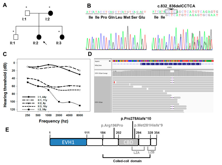 (A) Pedigree of the S1074 family indicating the segregation of c.832_836delCCTCA mutation in HOMER2. Black symbols indicate affected patients (carrying the mutation in heterozygosis), and white symbols correspond to normal hearing individuals (wild-type for the mutation studied). The subject pointed with an arrow is the index case (studied by OTO-NGS-v2 panel), and the ones marked with an asterisk were analysed by Sanger sequencing for segregation analysis. (B) Electropherograms corresponding to the wild-type (left) and mutant (right) sequences of a normal hearing and an affected individual, respectively. (C) Audiograms of the S1074 family. The data represented correspond to the average of the audiometric thresholds in both ears. (D) Integrative Genomics Viewer (IGV) (Broad Institute) screenshot showing the genomic region corresponding to the c.832_836delCCTCA mutation of HOMER2 and the translated protein stretch corresponding to exon 8 in the reverse orientation (NP_955362.1, HOMER2 long isoform, amino acid range 292–266), as HOMER2 is transcribed by using the DNA negative strand. (E) Schematic representation of the structure of HOMER2 long isoform (NP_955362.1). The different domains [7,14,21] and the mutations identified so far associated with hearing loss (in grey) are shown. The mutation identified in this work is shown in black. EVH1 (1–111 aa): Enabled/vasodilator-stimulated phosphoprotein (Ena/VASP) homology 1; Coiled-coil domain (184–328 aa); CBD (202–294 aa): CDC42-binding domain. LZA (249–307 aa): Leucine Zipper-A; LZB (322–350 aa): Leucine Zipper-B.
