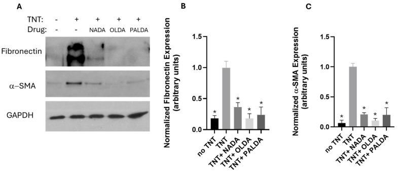 The effects of N-acyl dopamines on α-SMA and fibronectin expression in transdifferentiated human RPE cells. Cells were plated on collagen gels and treated with the vehicle or OLDA, PALDA, or NADA, plus TNT (10 ng/mL) for 72 h, released from the plate, and allowed to contract for 4 h. Gels were collected, cells lysed, resolved with SDS-PAGE, immunoblotted, and probed with antibodies against α-SMA, fibronectin, and GAPDH. (A) Representative Western blot images showing the expression levels of myofibroblast markers fibronectin and α-SMA and loading control GAPDH. Quantification of band intensity for fibronectin (B) and α-SMA (C) was performed using NIH Image J, normalized to the loading control GAPDH band intensity, and expressed as fold-change, relative to TNT treatment alone. Data are presented as mean ± SEM. * Significantly different from TNT alone, one-way ANOVA with Dunnett’s post-test (p < 0.05).