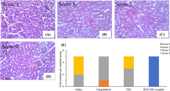 H&E staining of kidney tissue extracted from nude mice xenografts at 200× magnification.A) abnormal histological appearance of the kidney in the control group, such as poorly differentiated morphology of glomerulus surrounded by inflammatory cell infiltrates (green elliptic curve). Thrombosis was also examined in the tissue section as presented by vascular injury. B) CPT injury as observed through glomerular basement membrane thickening and red stained cytoplasm (red elliptic curve) C) Feature of glomerular hypercellularity, enlarged tubular epithelial cells and mild mononuclear inflammatory aggregation were observed in the THC treatment group. D) Kidney architecture was well-distributed with no fibrosis on the βCD-THC complex group. E) Stack bar graph summarizing numbers of neonates with 0–3 scores based on treatment groups. Score 0- normal, 1- mild, 2- moderate, and 3- severe.
