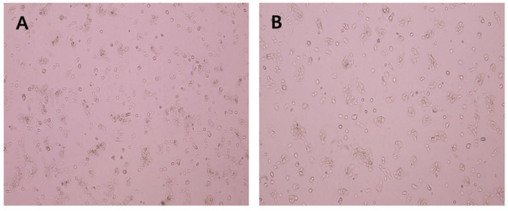 Effect of ethanol extract of propolis (EEP) on the morphology of A431 cells (100×): (A): Control, (B) IC50 EEP group.