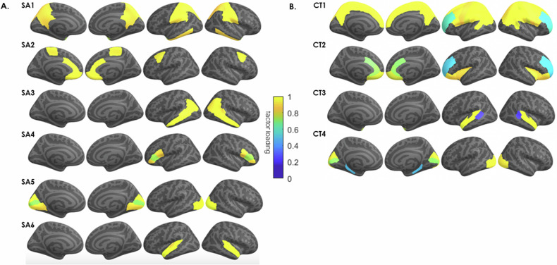 Genetically Informed Brain Networks (GIBNs).Genomic structural equation modeling (gSEM) jointly modeled the genetic architecture of (A) cortical surface area (SA), and (B) cortical thickness, for 34 brain regions based on GWAS results of Grasby et al. [18]. The model generated 6 genetically informed brain networks (GIBNs) from SA phenotype measures. The color overlay on cortical regions represents the magnitude of the factor loadings indicated in the color gradient (yellow = high; blue = low). Subsequent GWAS identified several genome-wide significant hits (p < 5 × 10−8) associated with each GIBN.
